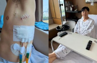 Shin Tae-yong baru-baru ini memamerkan foto dirinya pasca menjalani operasi