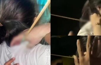 Ngeri! Wanita di Makassar Histeris Kena Busur Nyasar Saat Mau Makan Bakso KENA BUSUR NYASAR - Kolase korban di Makassar terkena busur nyasar tertancap di pundak viral di media sosial pada Senin (22/9/2025)